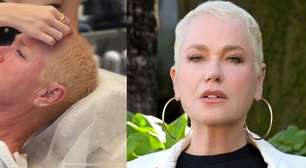 Cabelo fino e quebradiço: veja como identificá-lo e resolver o problema a tempo