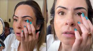 É seguro usar lentes coloridas com grau? Entenda caso de Ana Paula Renault