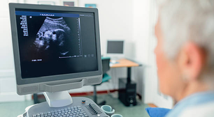 Ultrassom colorido pode otimizar resultados de exames