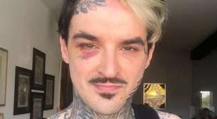 PC Siqueira: perícia particular aponta assassinato com fio de fone