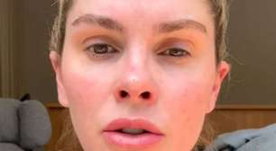 'Estou até tremendo': Bárbara Evans expõe luta contra dependência química após 5 anos, recaída e alerta sobre saúde