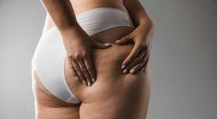 Dieta anticelulite existe mesmo?