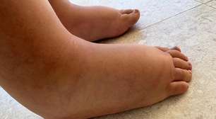 A luta de Dai: arrecadação de fundos para cirurgia urgente