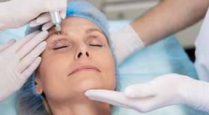 Blefaroplastia remodela pálpebras e rejuvenesce o olhar