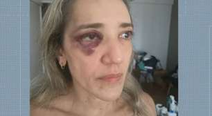 Passageira é agredida por motociclista de aplicativo após reclamar de capacete sem viseira no Rio