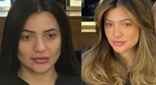 Veja o antes e depois do procedimento capilar que fez mulher esfaquear cabelereiro em SP