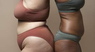 Lipedema: entenda o tratamento, que envolve cirurgia e nutrologia