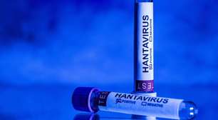 Mais de 20 franceses expostos ao hantavírus estão 'atualmente hospitalizados'