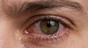 Triquíase: problema nos cílios pode causar irritação e desconforto ocular