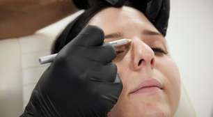 Noivas investem em cuidados com a pele antes do casamento