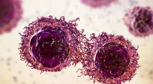 Novo tratamento com pembrolizumabe pode manter pacientes com câncer colorretal livres da doença por anos
