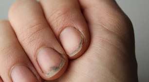 As marcas do tempo nas unhas: como o corpo registra doenças e estresse físico