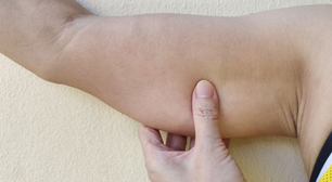 Para eliminar a flacidez da parte interna do braço você deve incluir esses 4 exercícios no seu treino