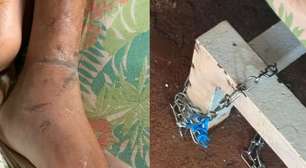 Mãe é presa por suspeita de torturar o próprio filho e mantê-lo acorrentado em Goiás