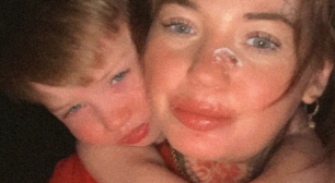 Mãe e filho descobrem doença genética rara após anos de infecções fúngicas crônicas