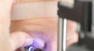 Dia do glaucoma: doença silenciosa exige diagnóstico precoce e acompanhamento contínuo