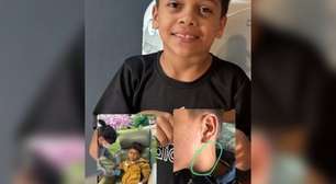 Ajude na cirurgia do tumor na região arterial: a luta de João Gabriel