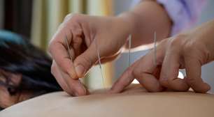 Acupuntura se consolida como prática terapêutica