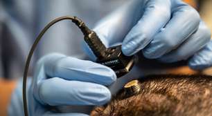Conectando dois neurônios com um fio: experimento de neurocientistas cria um "bypass" entre cérebros
