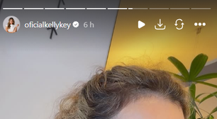 Kelly Key reclama de flacidez no pescoço: veja o que causa e como cuidar