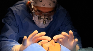 Rinoplastia ultrassônica avança em cirurgias nasais