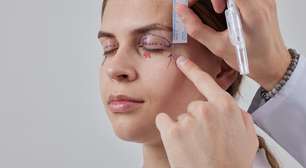 Blefaroplastia exige avaliação pré-cirúrgica individualizada