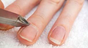 Tirar a cutícula toda semana pode prejudicar suas unhas? Entenda os riscos