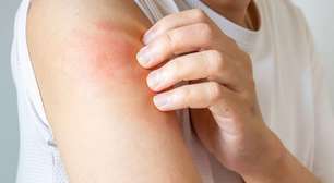 Corpo coçando sem parar? Veja as possíveis causas e o que fazer