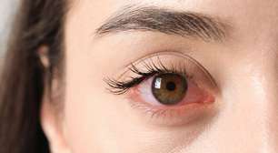 Visão embaçada? Veja como proteger a saúde dos olhos com a alimentação