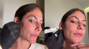 Mari Gonzalez mostra procedimento para fechar orelha rasgada: 'Achei que ia precisar de cirurgia'