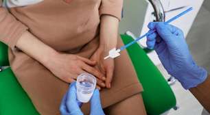 Preparo para exame papanicolau: 10 coisas que você precisa saber
