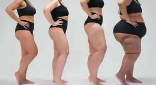 Quem tem lipedema pode correr?