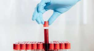 Pesquisa em psiquiatria molecular identifica sinais biológicos associados à depressão, mas diagnóstico por sangue ainda é futuro