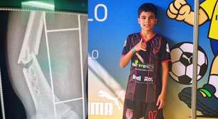 A cirurgia do Cauê: a luta de um garoto pelo sonho de ser jogador de futebol