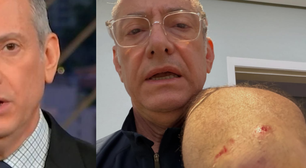 Âncora da Globo, José Roberto Burnier leva 4 pontos após ataque de pitbull sem guia: 'O preço da irresponsabilidade'