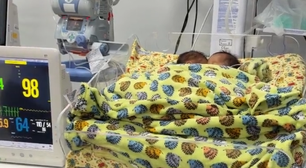 Bebês siameses morrem após quadro infeccioso em Goiás