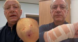 Veja o ferimento em âncora da Globo atacado por pitbull sem focinheira em SP