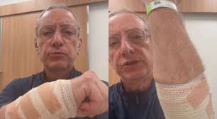 Jornalista da Globo fica gravemente ferido após ataque de pitbull; veja como ele está