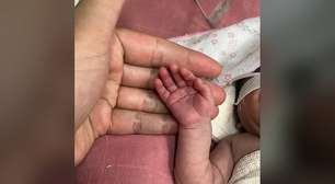 Todos pela vida da bebê Olívia: uma história de luta e esperança
