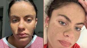 Caveman Skincare: a tendência viral que pode prejudicar sua pele