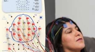 Glucosamina e Alzheimer: estudo aponta possível associação e levanta alerta sobre suplemento popular
