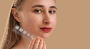 Adesivos para espinhas funcionam mesmo? Dermatologista responde