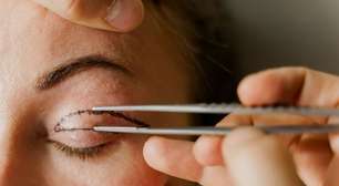 Pálpebras caídas, olhar cansado: quando a blefaroplastia pode fazer sentido?