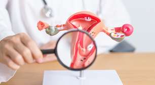 Nem todo mioma precisa de cirurgia: especialista explica quando apenas acompanhar é a melhor opção