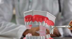 Dente do siso: entenda por que ele existe e quando a extração é necessária