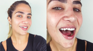 Jéssica Beatriz, filha de Leonardo, exibe novo sorriso após arrumar os dentes quebrados em tombo
