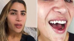 Filha de Leonardo vive noite romântica que acaba em acidente: 'Um desastre'