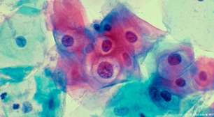 Os entraves para o avanço da vacinação contra o HPV no Brasil