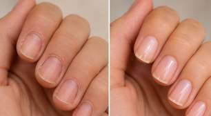 Cutículas ressecadas? Aprenda a cuidar delas em casa de forma prática e segura