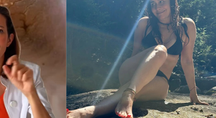Ana Molina, dermatologista: 'Se você tem tendência a rachaduras nos pés, é melhor usar sandálias com o calcanhar coberto ou, pelo menos, com boa fixação na parte de trás'